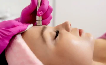 Microdermobrasion Treatment in NYC